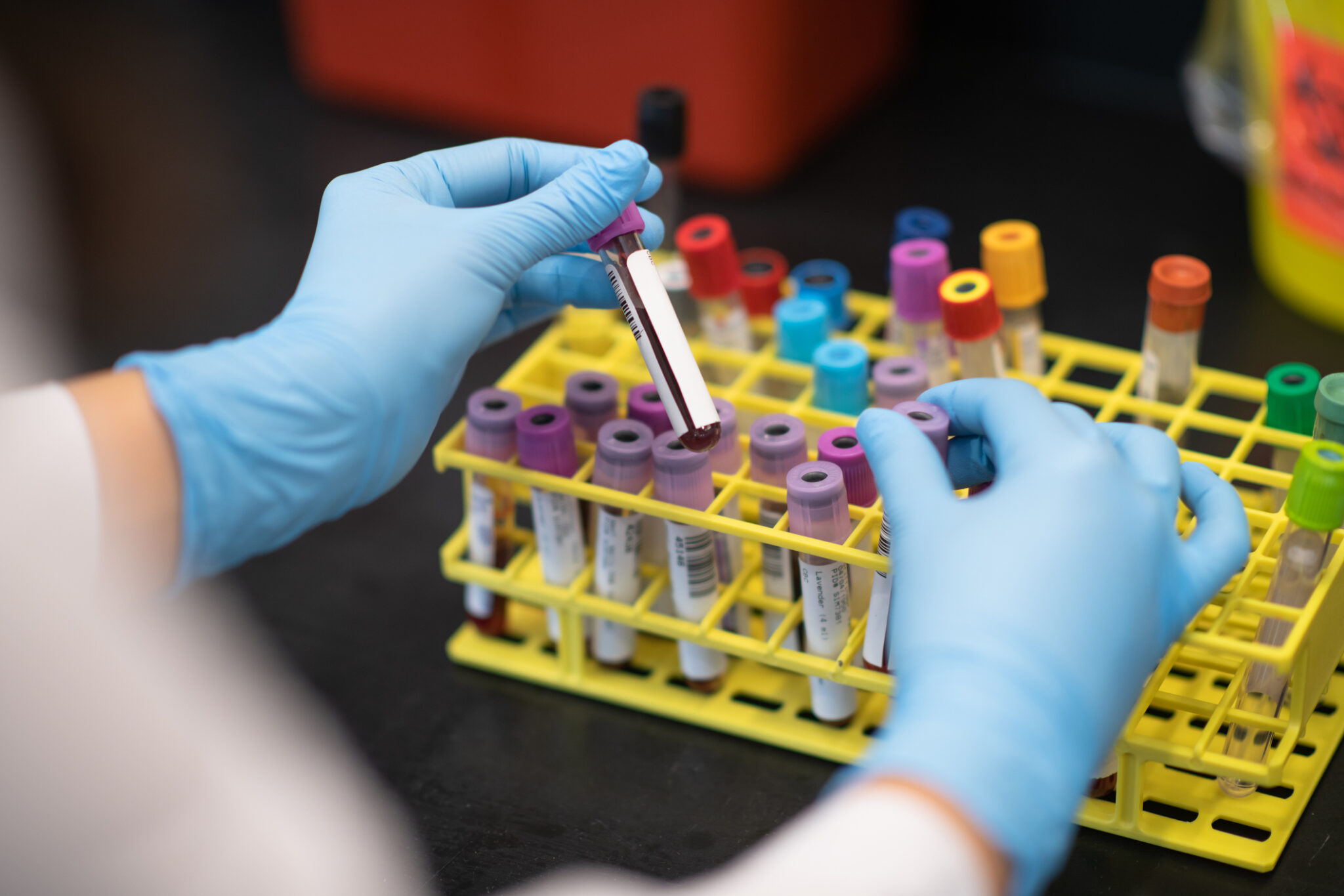 Thinking About Type 1 Diabetes Autoantibody Screening? Here’s What to Consider